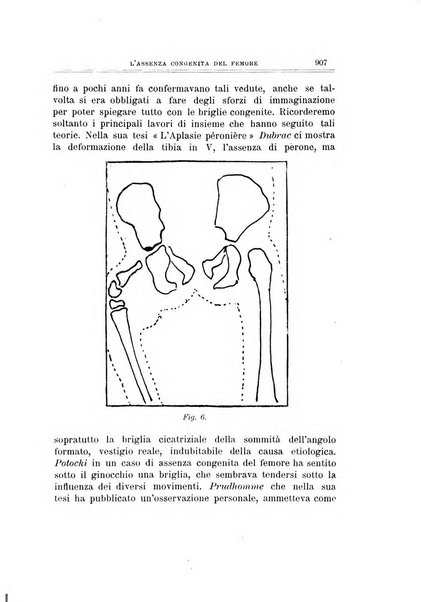 Archivio di ortopedia pubblicazione ufficiale del Pio istituto dei rachitici <1924-1950>