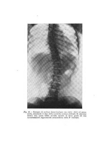 Archivio di ortopedia pubblicazione ufficiale del Pio istituto dei rachitici <1924-1950>