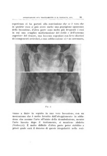 Archivio di ortopedia pubblicazione ufficiale del Pio istituto dei rachitici <1924-1950>