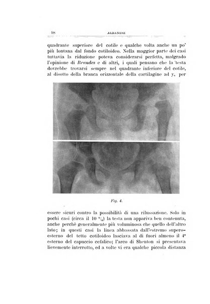 Archivio di ortopedia pubblicazione ufficiale del Pio istituto dei rachitici <1924-1950>