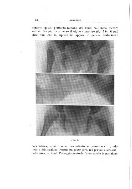 Archivio di ortopedia pubblicazione ufficiale del Pio istituto dei rachitici <1924-1950>