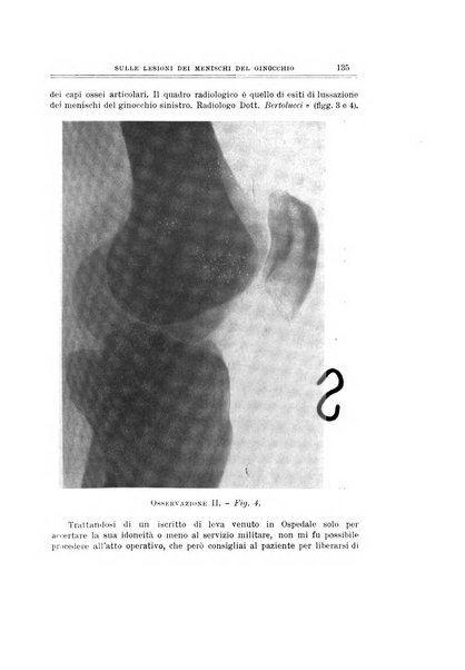 Archivio di ortopedia pubblicazione ufficiale del Pio istituto dei rachitici <1924-1950>