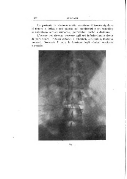 Archivio di ortopedia pubblicazione ufficiale del Pio istituto dei rachitici <1924-1950>