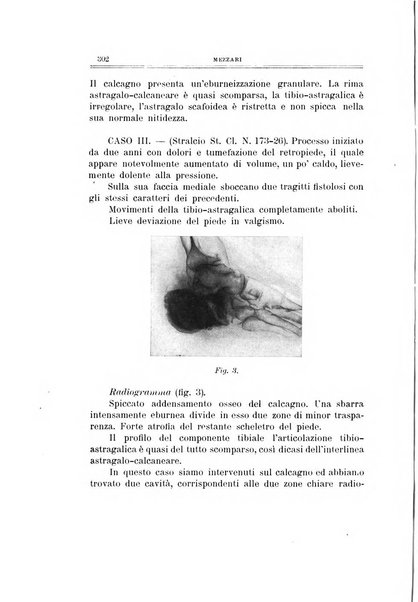 Archivio di ortopedia pubblicazione ufficiale del Pio istituto dei rachitici <1924-1950>