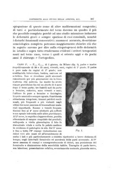 Archivio di ortopedia pubblicazione ufficiale del Pio istituto dei rachitici <1924-1950>