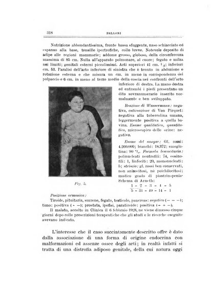 Archivio di ortopedia pubblicazione ufficiale del Pio istituto dei rachitici <1924-1950>