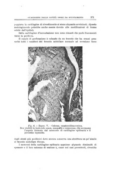 Archivio di ortopedia pubblicazione ufficiale del Pio istituto dei rachitici <1924-1950>