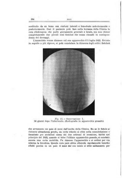 Archivio di ortopedia pubblicazione ufficiale del Pio istituto dei rachitici <1924-1950>