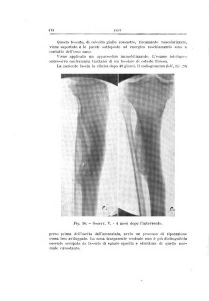 Archivio di ortopedia pubblicazione ufficiale del Pio istituto dei rachitici <1924-1950>