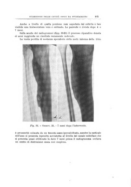 Archivio di ortopedia pubblicazione ufficiale del Pio istituto dei rachitici <1924-1950>