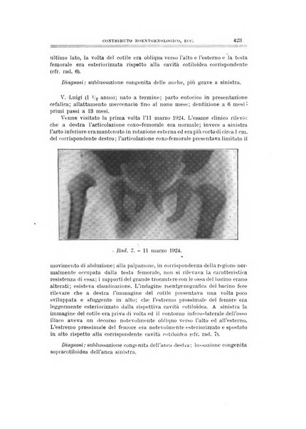 Archivio di ortopedia pubblicazione ufficiale del Pio istituto dei rachitici <1924-1950>