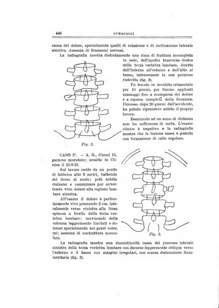 Archivio di ortopedia pubblicazione ufficiale del Pio istituto dei rachitici <1924-1950>