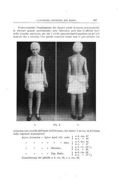 Archivio di ortopedia pubblicazione ufficiale del Pio istituto dei rachitici <1924-1950>