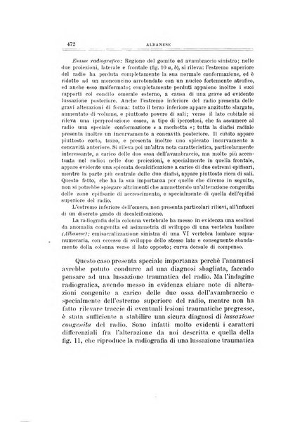 Archivio di ortopedia pubblicazione ufficiale del Pio istituto dei rachitici <1924-1950>