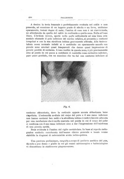 Archivio di ortopedia pubblicazione ufficiale del Pio istituto dei rachitici <1924-1950>