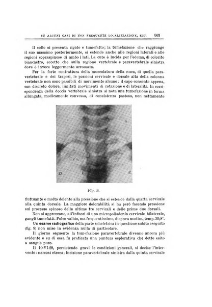 Archivio di ortopedia pubblicazione ufficiale del Pio istituto dei rachitici <1924-1950>