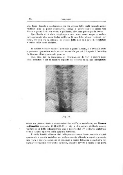 Archivio di ortopedia pubblicazione ufficiale del Pio istituto dei rachitici <1924-1950>