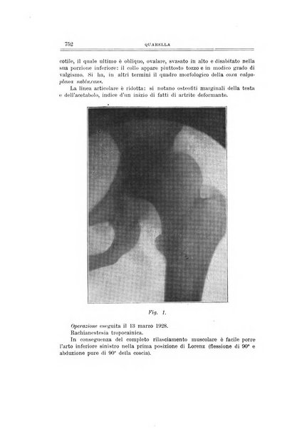 Archivio di ortopedia pubblicazione ufficiale del Pio istituto dei rachitici <1924-1950>