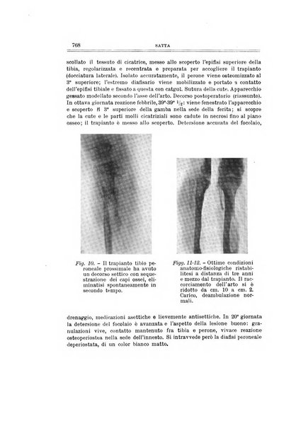 Archivio di ortopedia pubblicazione ufficiale del Pio istituto dei rachitici <1924-1950>