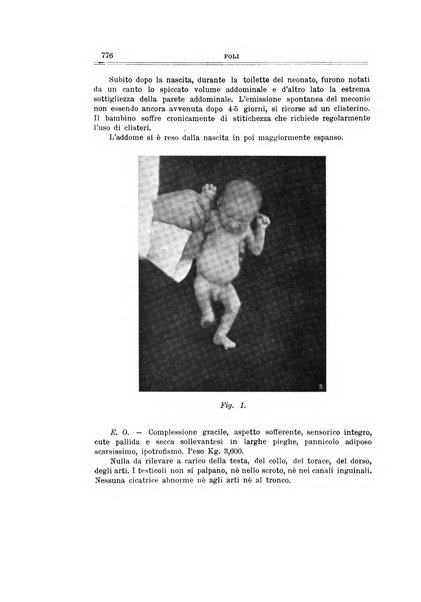 Archivio di ortopedia pubblicazione ufficiale del Pio istituto dei rachitici <1924-1950>