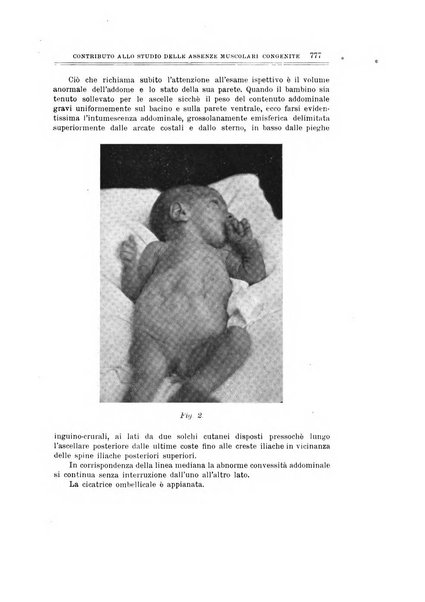 Archivio di ortopedia pubblicazione ufficiale del Pio istituto dei rachitici <1924-1950>