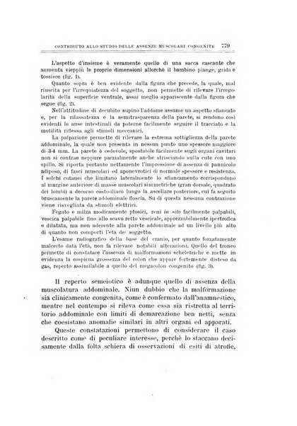 Archivio di ortopedia pubblicazione ufficiale del Pio istituto dei rachitici <1924-1950>