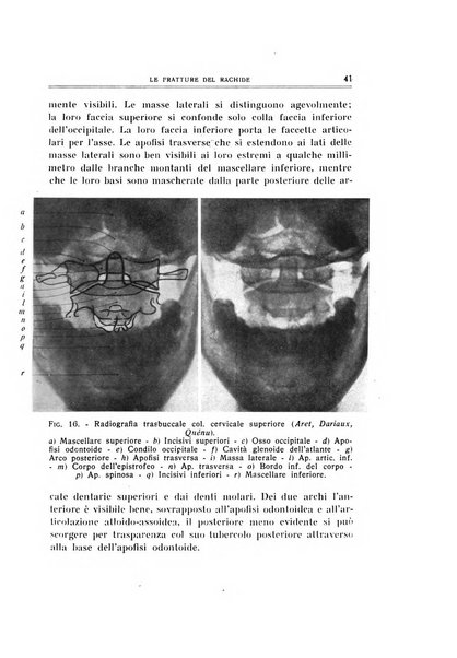 Archivio di ortopedia pubblicazione ufficiale del Pio istituto dei rachitici <1924-1950>