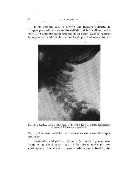 Archivio di ortopedia pubblicazione ufficiale del Pio istituto dei rachitici <1924-1950>