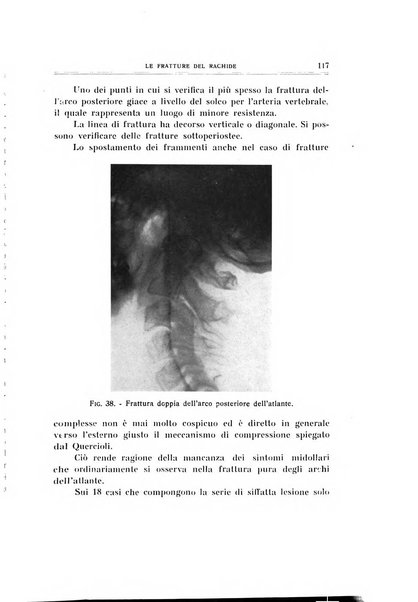 Archivio di ortopedia pubblicazione ufficiale del Pio istituto dei rachitici <1924-1950>