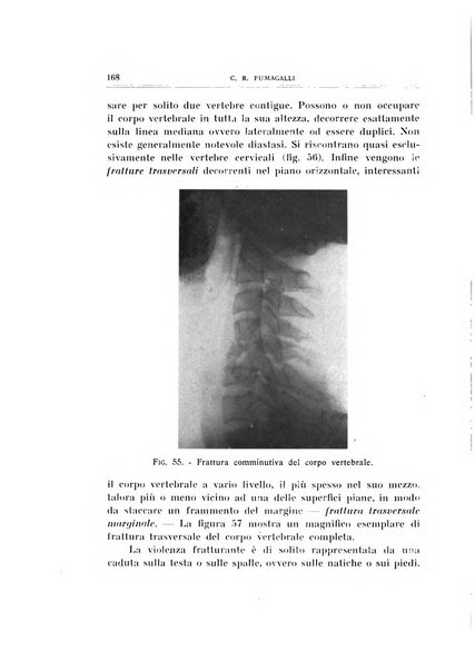 Archivio di ortopedia pubblicazione ufficiale del Pio istituto dei rachitici <1924-1950>