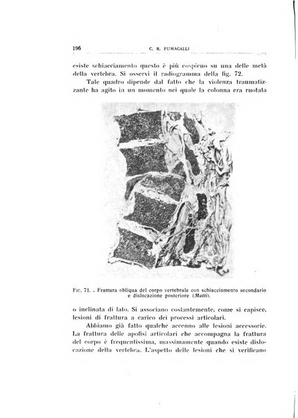 Archivio di ortopedia pubblicazione ufficiale del Pio istituto dei rachitici <1924-1950>