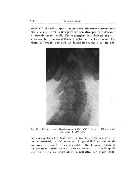 Archivio di ortopedia pubblicazione ufficiale del Pio istituto dei rachitici <1924-1950>