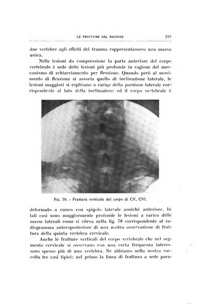 Archivio di ortopedia pubblicazione ufficiale del Pio istituto dei rachitici <1924-1950>