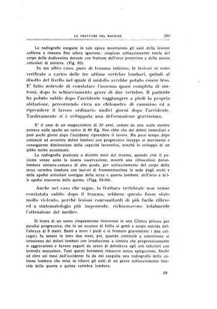 Archivio di ortopedia pubblicazione ufficiale del Pio istituto dei rachitici <1924-1950>