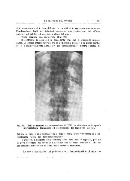 Archivio di ortopedia pubblicazione ufficiale del Pio istituto dei rachitici <1924-1950>