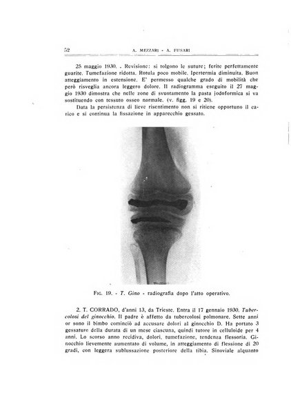 Archivio di ortopedia pubblicazione ufficiale del Pio istituto dei rachitici <1924-1950>