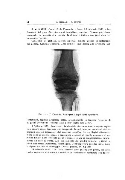 Archivio di ortopedia pubblicazione ufficiale del Pio istituto dei rachitici <1924-1950>