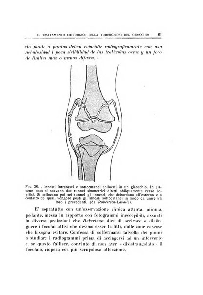 Archivio di ortopedia pubblicazione ufficiale del Pio istituto dei rachitici <1924-1950>