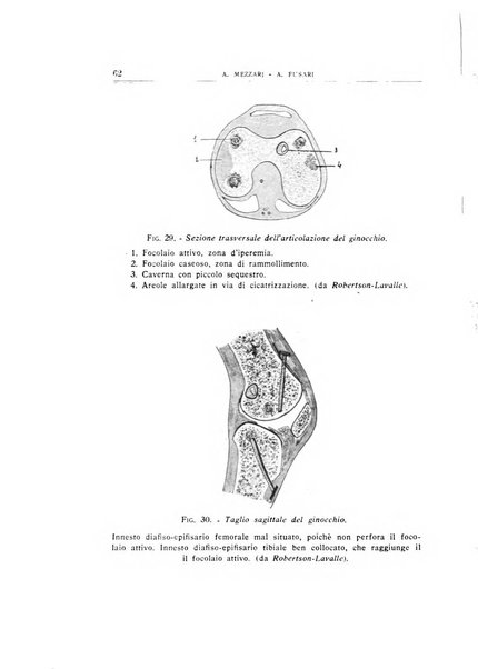 Archivio di ortopedia pubblicazione ufficiale del Pio istituto dei rachitici <1924-1950>