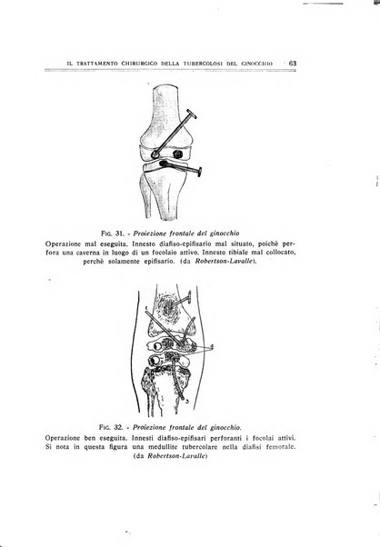 Archivio di ortopedia pubblicazione ufficiale del Pio istituto dei rachitici <1924-1950>