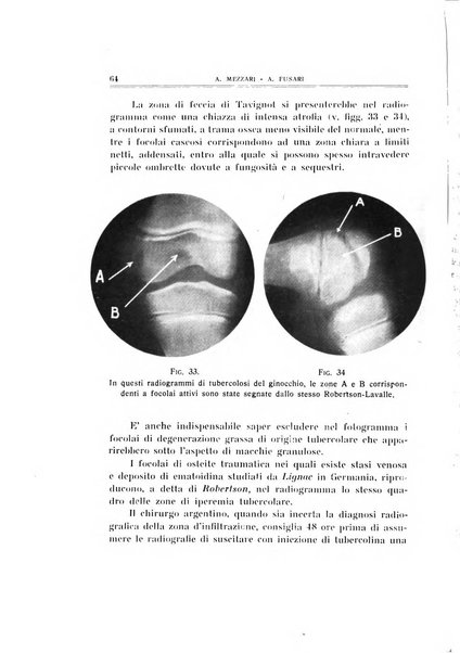 Archivio di ortopedia pubblicazione ufficiale del Pio istituto dei rachitici <1924-1950>