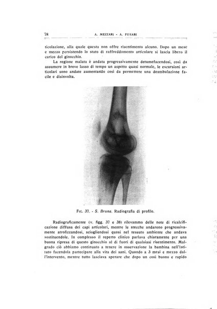 Archivio di ortopedia pubblicazione ufficiale del Pio istituto dei rachitici <1924-1950>