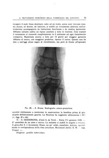 Archivio di ortopedia pubblicazione ufficiale del Pio istituto dei rachitici <1924-1950>