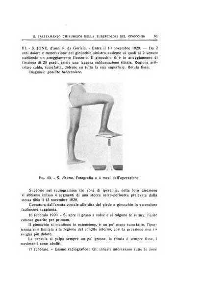 Archivio di ortopedia pubblicazione ufficiale del Pio istituto dei rachitici <1924-1950>