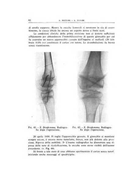 Archivio di ortopedia pubblicazione ufficiale del Pio istituto dei rachitici <1924-1950>