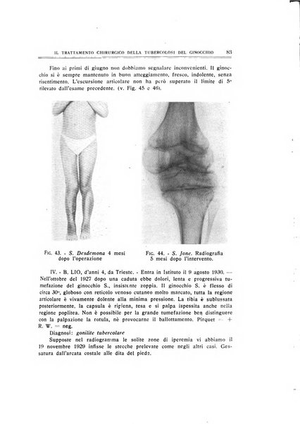 Archivio di ortopedia pubblicazione ufficiale del Pio istituto dei rachitici <1924-1950>