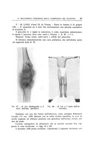 Archivio di ortopedia pubblicazione ufficiale del Pio istituto dei rachitici <1924-1950>