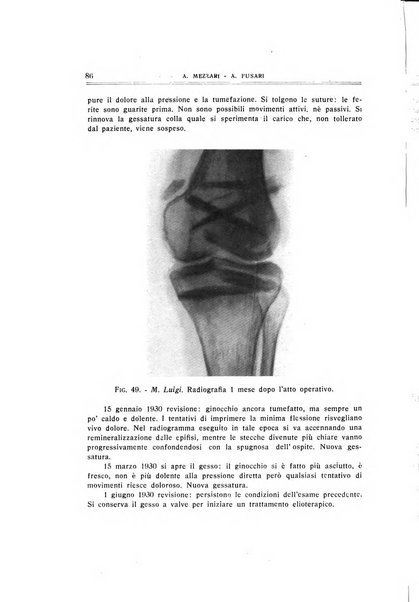 Archivio di ortopedia pubblicazione ufficiale del Pio istituto dei rachitici <1924-1950>