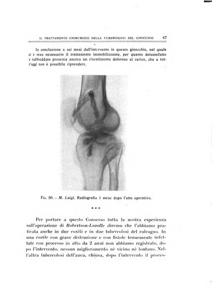 Archivio di ortopedia pubblicazione ufficiale del Pio istituto dei rachitici <1924-1950>