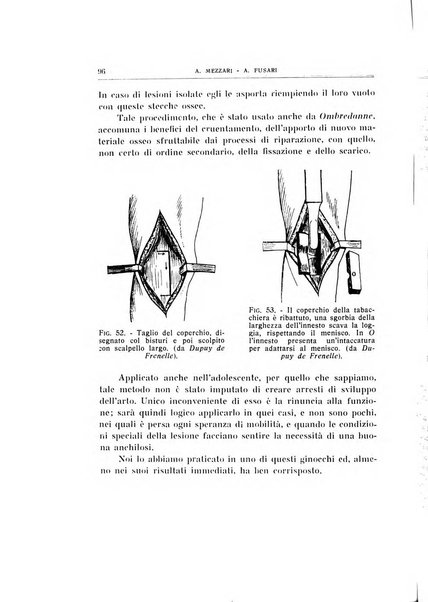 Archivio di ortopedia pubblicazione ufficiale del Pio istituto dei rachitici <1924-1950>